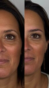 MICROBLADING VENDEE ISTOIRES DE DAMES MAQUILLAGE PERMANENT SOURCIL BLADING LA ROCHE SUR YON